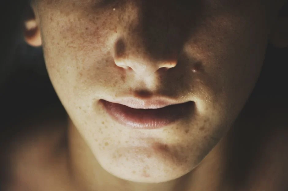 Dark spots nose